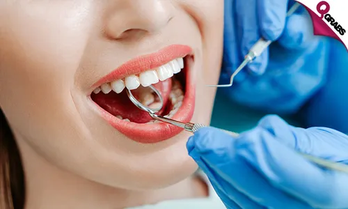 Dental Scaling, Polishing, Prophy-Jet, Tooth Filling & More!